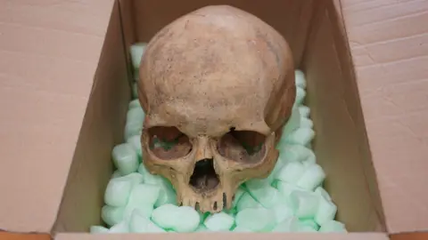A Unexpected Return: Tourist Returns Skull Stolen from Vienna Cathedral 60 Years Ago