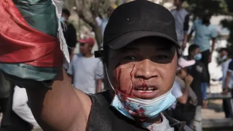 Tensions Rise in Madagascar as President Accuses Armed Forces of Power Grab